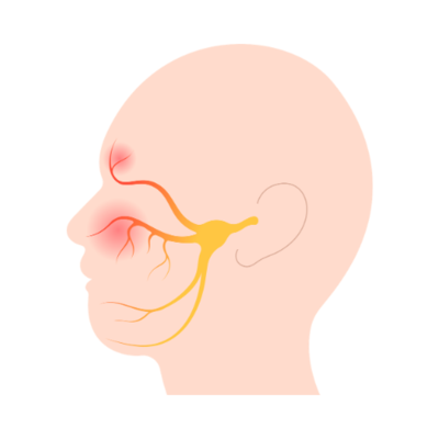 Coloured anatomical illustration of a side profile head showing facial nerve pathways highlighted in red, on a transparent background