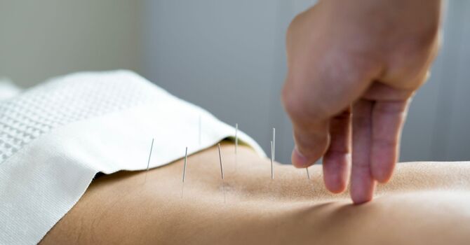 Facial Acupuncture